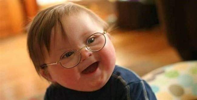 Otizm tedavisinde yeni yöntem Ergoterapi