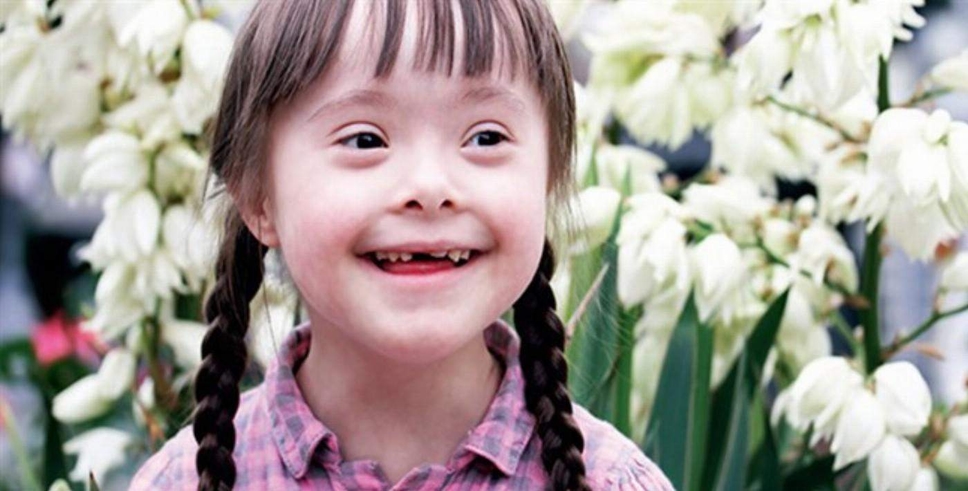 Down sendromlu bireylere nasıl yaklaşılmalı