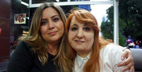 Yaşadığı acının izlerini psikoloji okuyarak yenecek