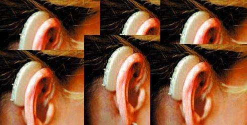 İşitme kaybı sonrası bunamaya dikkat!