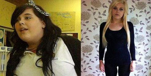 'Çok mutsuzum şişmanlamak istiyorum'