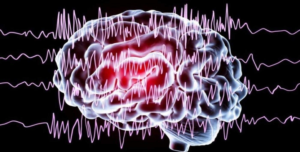 Epilepsi krizi neden olur?