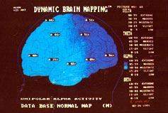 psikiyatride tani yontemleri beyin haritalamasi qeeg ceeg  Beyin Haritalaması   Kantitatif EEG/ QEEG