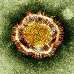 corona-virusu